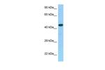 GPR30 Polyclonal Antibody