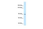 DACT1 Polyclonal Antibody
