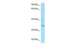 MSANTD3 Polyclonal Antibody