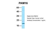 CORO7-PAM16 Polyclonal Antibody