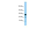 IL22RA2 Polyclonal Antibody