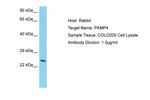 PXMP4 Polyclonal Antibody