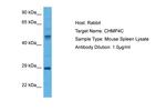 CHMP4C Polyclonal Antibody