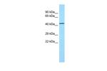 TOR1AIP2 Polyclonal Antibody