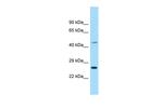 EIF4E1B Polyclonal Antibody
