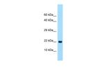 CLEC2A Polyclonal Antibody