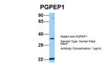 PGPEP1 Polyclonal Antibody