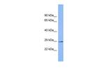 MTRES1 Antibody in Western Blot (WB)