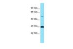 TMEM65 Polyclonal Antibody