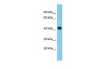 MYLK4 Polyclonal Antibody