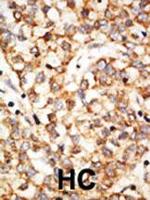 APOBEC1 Polyclonal Antibody