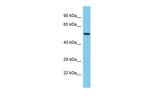 TBX20 Polyclonal Antibody