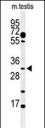 APOBEC3B Polyclonal Antibody