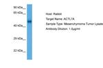 Actin-like 7A Polyclonal Antibody