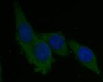 Syntrophin alpha-1 Polyclonal Antibody