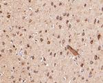 KCNK18 Antibody in Immunohistochemistry (Paraffin) (IHC (P))