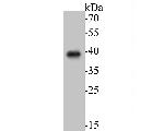 ADT2 Antibody in Western Blot (WB)