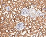 P2X1 Antibody in Immunohistochemistry (Paraffin) (IHC (P))