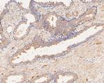 P2X1 Polyclonal Antibody