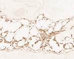 HDG11 Polyclonal Antibody