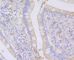 SPATA5L1 Polyclonal Antibody