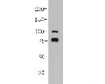 SPATA5L1 Antibody in Western Blot (WB)