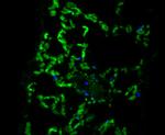 ECH Polyclonal Antibody