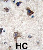 CDH4 Polyclonal Antibody