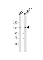 CDH4 Antibody in Western Blot (WB)