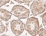 C19orf63 Antibody in Immunohistochemistry (Paraffin) (IHC (P))