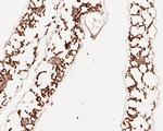 AP4E1 Antibody in Immunohistochemistry (Paraffin) (IHC (P))