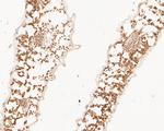Beta-adaptin-like protein A Polyclonal Antibody