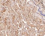 GSDMC Antibody in Immunohistochemistry (Paraffin) (IHC (P))