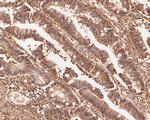 TMX4 Antibody in Immunohistochemistry (Paraffin) (IHC (P))