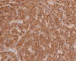 TMX4 Antibody in Immunohistochemistry (Paraffin) (IHC (P))