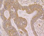 SPATA13 Antibody in Immunohistochemistry (Paraffin) (IHC (P))