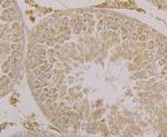 SPATA13 Antibody in Immunohistochemistry (Paraffin) (IHC (P))