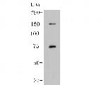 SPATA13 Antibody in Western Blot (WB)