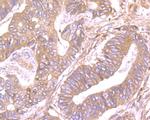 SDF1 Polyclonal Antibody