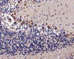 KCNN2 Polyclonal Antibody