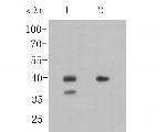 Nkx2.1 Polyclonal Antibody