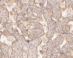 SLC12A9 Polyclonal Antibody
