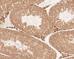 SLC12A9 Antibody in Immunohistochemistry (Paraffin) (IHC (P))