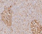 SLFN12 Antibody in Immunohistochemistry (Paraffin) (IHC (P))