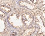 SLFN12 Antibody in Immunohistochemistry (Paraffin) (IHC (P))