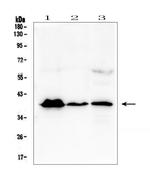 MR1 Polyclonal Antibody