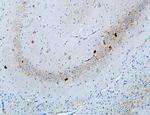 MTR Antibody in Immunohistochemistry (Paraffin) (IHC (P))