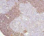 Cd8a Antibody in Immunohistochemistry (Paraffin) (IHC (P))