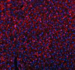 MRC1 Antibody in Immunohistochemistry (Paraffin) (IHC (P))