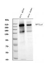 NUP214 Antibody in Western Blot (WB)